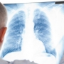 O que é enfisema pulmonar e quais os sintomas?